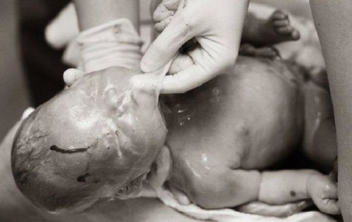Khoảnh khắc khi mà nữ hộ sinh lấy lớp màng ra khỏi cơ thể bé sau khi chào đời được chụp lại bởi nhiếp ảnh gia Lynsey.