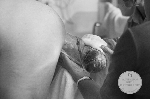 Bức ảnh sinh con trong bọc ối của nhiếp ảnh gia người Úc Lacey Barratt 