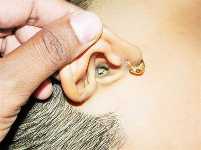 Bạn có từng nghĩ đến tương lai mọc nấm trong lỗ tai thế này chưa? 