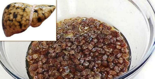 how-to-cleanse-your-liver-with-raisins-and-water-1456980704431-0-0-514-1007-crop-1456980749062