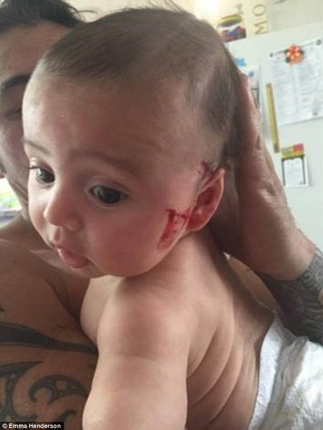 Bé trai 3 tháng tuổi với những vết cắt lớn trên má.