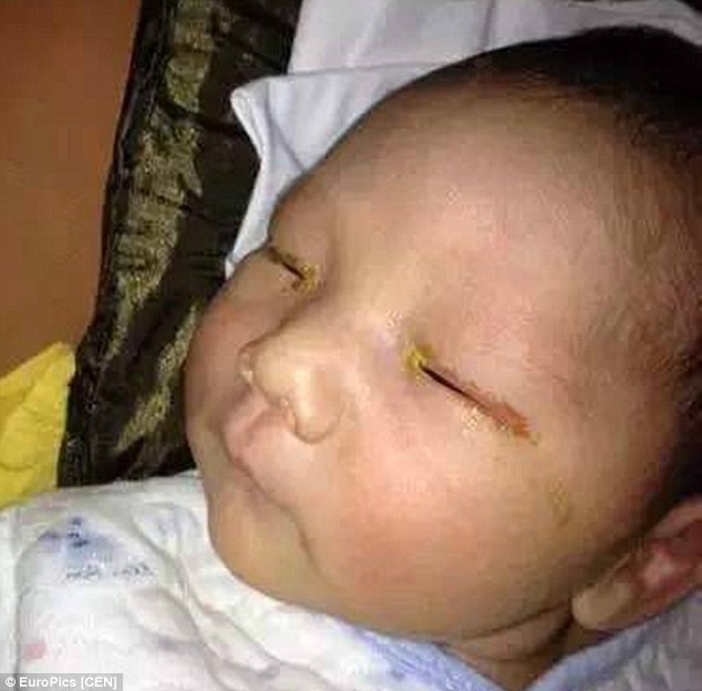 2ae1105200000578-3176237-a-three-month-old-baby-has-been-left-blind-after-a-family-friend-m-21-1438014547432-1477024707226
