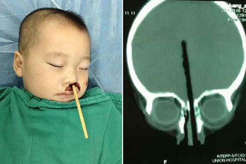 Hình ảnh của Huang Zicheng ở bệnh viện.