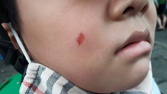 Một giáo viên ở Đà Nẵng xông vào trường đánh giáo viên vì con bị xước mặt. Ảnh: Facebook.