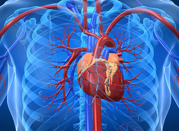 Ở nước ta, bệnh tim mạch là nguyên nhân gây ra cái chết cho 25% trường hợp tử vong