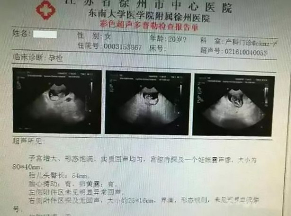 Theo kết quả siêu âm, bé gái đã mang thai được 3 tháng