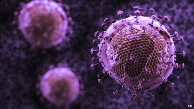 Tế bào máu cần được phá hủy trước khi chữa trị, nhằm ngăn cản HIV tiếp tục có nơi cư trú