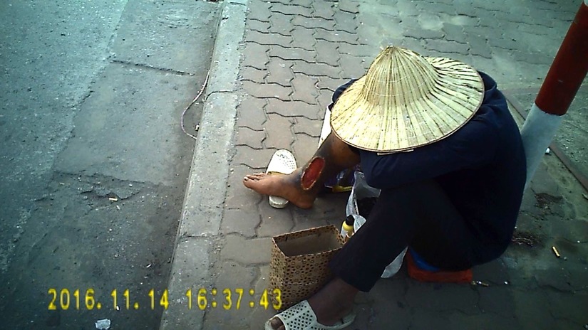 Thanh niên ăn xin với chiếc chân bị hoại tử xuất hiện ở ngã tư Giải Phóng - Đại Cồ Việt