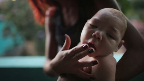 Virus Zika gây dị tật đầu nhỏ ở trẻ sơ sinh