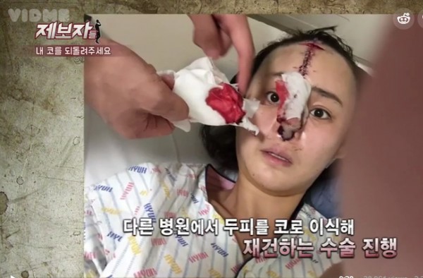 Cô Kim Min Joo không ngờ hậu quả của ca phẫu thuật lại rùng rợn đến mức này