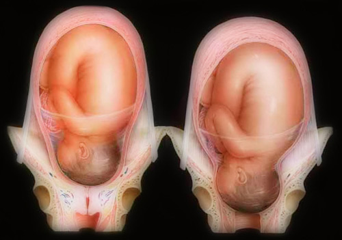 Trong quá trình sinh con, cơ thể mẹ sẽ trải qua rất nhiều thay đổi và có thể nói cổ tử cung là bộ phận thay đổi nhiều nhất. (ảnh minh họa)