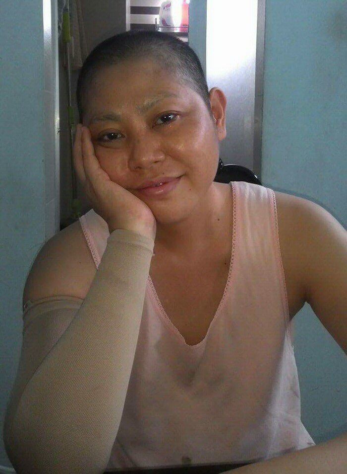 Chị Trang sau khi đã phẫu thuật cắt bỏ ngực
