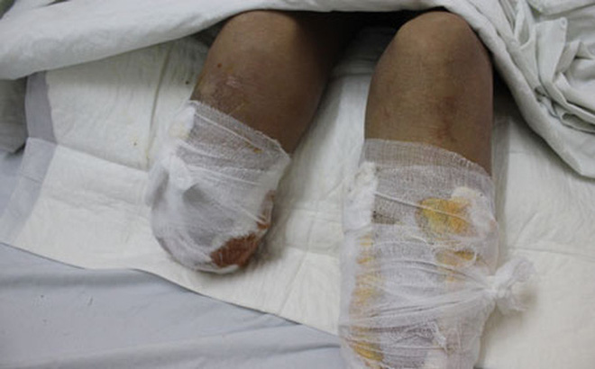 Nguyên nhân nhân viên bệnh viện tự cắt cụt chân đem giấu trong tủ ở Cần Thơ