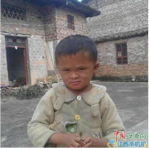 Fan Xiaoqin, 8 tuổi và đang sống ở Vĩnh Phong, tỉnh Giang Tây, phía đông của Trung Quốc